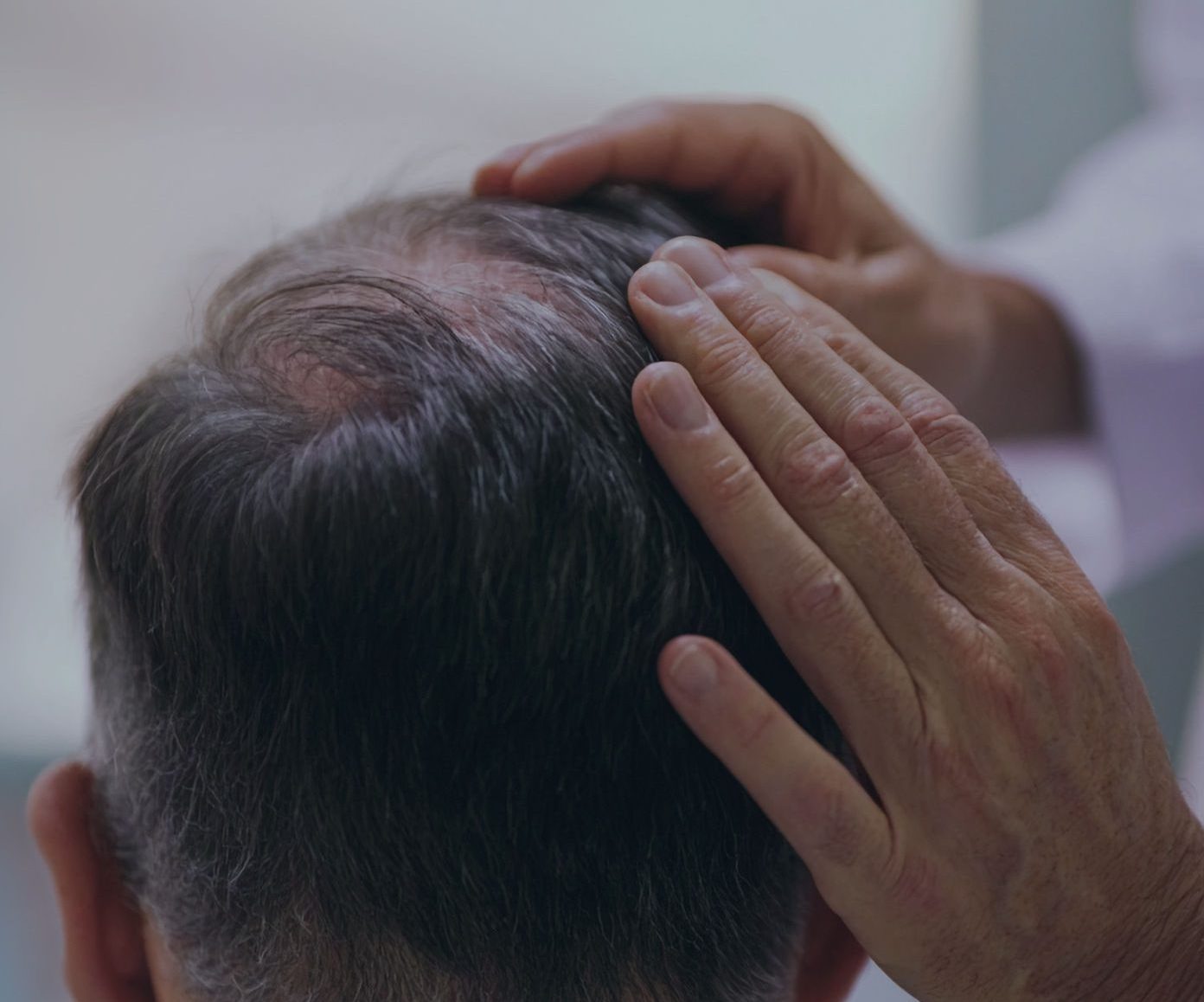 Dermatologist examining an older man's scalp during a skin exam.